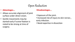 Open Reduction
• Advantages...
• Allows accurate alignment of joint
surface under direct vision.
• Gentle movements may be
started early if screw fixation is
noted to be strong at time of
surgery.
•Disadvantages...
• Exposure of the joint.
• Increased risk of injury to skin nerves ,
early infection.
• Need expertise in dissection
 