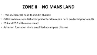 ZONE II – NO MANS LAND
• From metacarpal head to middle phalanx
• Called so because initial attempts for tendon repair here produced poor results
• FDS and FDP within one sheath
• Adhesion formation risk is amplified at campers chiasma
 