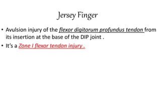 Jersey Finger
• Avulsion injury of the flexor digitorum profundus tendon from
its insertion at the base of the DIP joint .
• It’s a Zone I flexor tendon injury .
 