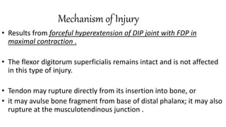 Mechanism of Injury
• Results from forceful hyperextension of DIP joint with FDP in
maximal contraction .
• The flexor digitorum superficialis remains intact and is not affected
in this type of injury.
• Tendon may rupture directly from its insertion into bone, or
• it may avulse bone fragment from base of distal phalanx; it may also
rupture at the musculotendinous junction .
 