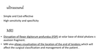 MRI
• Disruption of flexor digitorum profundus (FDP) at volar base of distal phalanx ±
avulsion fragment.
• MRI also allows visualisation of the location of the end of tendons which will
affect the surgical classification and management of the patient .
ultrasound
 Simple and Cost-effective
 High sensitivity and specificity
 