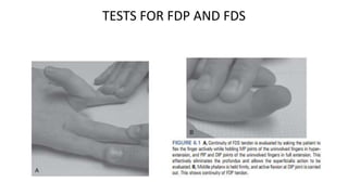 TESTS FOR FDP AND FDS
 
