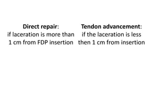 Direct repair:
if laceration is more than
1 cm from FDP insertion
Tendon advancement:
if the laceration is less
then 1 cm from insertion
 