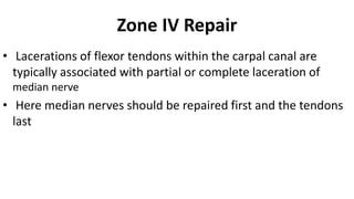 Zone IV Repair
• Lacerations of flexor tendons within the carpal canal are
typically associated with partial or complete laceration of
median nerve
• Here median nerves should be repaired first and the tendons
last
 