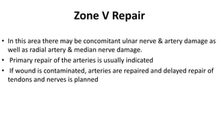 Zone V Repair
• In this area there may be concomitant ulnar nerve & artery damage as
well as radial artery & median nerve damage.
• Primary repair of the arteries is usually indicated
• If wound is contaminated, arteries are repaired and delayed repair of
tendons and nerves is planned
 