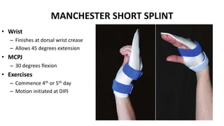 MANCHESTER SHORT SPLINT
• Wrist
– Finishes at dorsal wrist crease
– Allows 45 degrees extension
• MCPJ
– 30 degrees flexion
• Exercises
– Commence 4th or 5th day
– Motion initiated at DIPJ
 