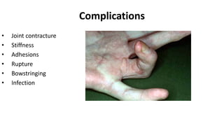 Complications
• Joint contracture
• Stiffness
• Adhesions
• Rupture
• Bowstringing
• Infection
 