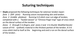 Suturing techniques
• Doyle proposed the following techniques for extensor tendon repair:
Zone 1 (DIP joint): Running suture incorporating skin and tendon.
Zone 2 (middle phalanx): Running 5-0 stitch near cut edge of tendon,
completed with a “basket-weave” or “Chinese finger trap” type of cross-stitch
on the dorsal surface of the tendon .
Zones 3 through 5 in fingers, and zones 2 and 3 in thumb: Modifed Kessler
suture of 4-0 synthetic material in the thickest portion of the tendon. A 5-0
cross-stitch tied to itself at the beginning and end is run on the dorsal surface
of the tendon .
 