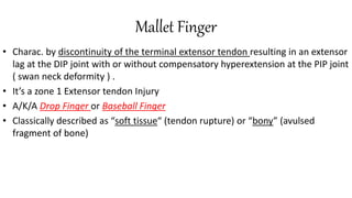Mallet Finger
• Charac. by discontinuity of the terminal extensor tendon resulting in an extensor
lag at the DIP joint with or without compensatory hyperextension at the PIP joint
( swan neck deformity ) .
• It’s a zone 1 Extensor tendon Injury
• A/K/A Drop Finger or Baseball Finger
• Classically described as “soft tissue“ (tendon rupture) or “bony” (avulsed
fragment of bone)
 