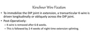 Kirschner Wire Fixation
• To immobilize the DIP joint in extension, a transarticular K-wire is
driven longitudinally or obliquely across the DIP joint.
• Post-Operatively:
– K-wire is removed after 6-8 weeks.
– This is followed by 2-4 weeks of night time extension splinting.
 