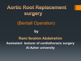 (Bentall Operation)
Rami Ibrahim Abdelrehim
Assisstant lecturer of cardiothoracic surgery
Al-Azher university
by
 
