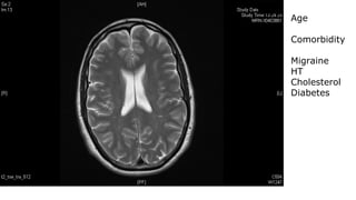 Age
Comorbidity
Migraine
HT
Cholesterol
Diabetes
 