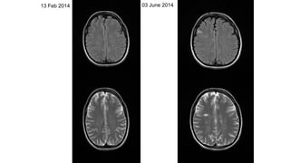 13 Feb 2014 03 June 2014
 