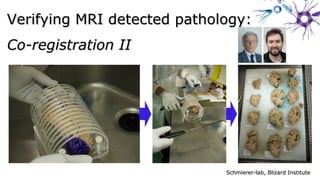 Verifying MRI detected pathology:Verifying MRI detected pathology:
Co-registration IICo-registration II
Schmierer-lab, Blizard InstituteSchmierer-lab, Blizard Institute
 