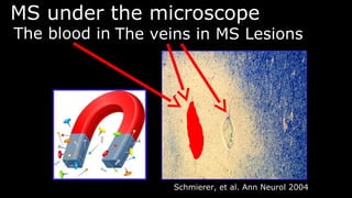 MS under the microscopeMS under the microscope
The veins in MS LesionsThe veins in MS Lesions
Schmierer, et al. Ann Neurol 2004Schmierer, et al. Ann Neurol 2004
The blood inThe blood in
 