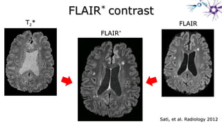 TT22** FLAIRFLAIR
FLAIRFLAIR**
Sati, et al. Radiology 2012Sati, et al. Radiology 2012
 