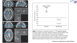 Mistry et al. JAMA Neurol. 2013;70:623-8.Mistry et al. JAMA Neurol. 2013;70:623-8.
 
