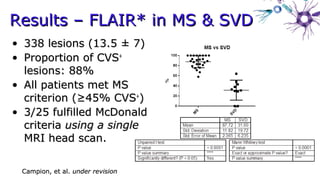 • 338 lesions (13.5 ± 7)338 lesions (13.5 ± 7)
• Proportion of CVSProportion of CVS++
lesions: 88%lesions: 88%
• All patients met MSAll patients met MS
criterion (≥45% CVScriterion (≥45% CVS++
))
• 3/25 fulfilled McDonald3/25 fulfilled McDonald
criteriacriteria using a singleusing a single
MRI head scan.MRI head scan.
Results – FLAIR* in MS & SVDResults – FLAIR* in MS & SVD
Campion, et al.Campion, et al. under revisionunder revision
 