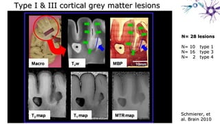 Schmierer, etSchmierer, et
al. Brain 2010al. Brain 2010
N= 28 lesionsN= 28 lesions
N= 10N= 10 type 1type 1
N= 16N= 16 type 3type 3
N= 2N= 2 type 4type 4
Type I & III cortical grey matter lesionsType I & III cortical grey matter lesions
 