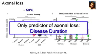 Axonal lossAxonal loss
- 60%- 60%
Petrova, et al. Brain Pathol 2018;28:334-48.Petrova, et al. Brain Pathol 2018;28:334-48.
Only predictor of axonal loss:Only predictor of axonal loss:
DDisease Durationisease Duration
 