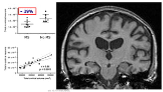 -- 39%39%
MSMS No MSNo MS
Carassiti D et al. Neuropathol Appl Nerobiol 2017; doi: 10.1111/nan.12405.doi: 10.1111/nan.12405.
 