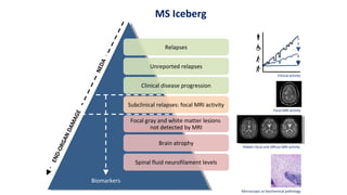 Relapses
Unreported relapses
Clinical disease progression
Subclinical relapses: focal MRI activity
Focal gray and white matter lesions
not detected by MRI
Brain atrophy
Spinal fluid neurofilament levels
MS Iceberg
Clinical activity
Focal MRI activity
Hidden focal and diffuse MRI activity
Microscopic or biochemical pathology
Biomarkers
NEDA
END-ORGANDAMAGE
 