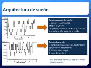 Arquitectura de sueño
Patrón normal de sueño
≈ 5 ciclos – 90 minutos.
Etapas 1-4 REM
progresan, se van acortando y ondas↓
lentas (3-4) a lo largo de la noche
Patrón insomnio
↓cantidad de sueño de ondas lentas (3-
4) c/ uno o + despertares
T de latencia + largo
T total de sueño ↓
Los ancianos tienen un patrón similar
al del insomnio
 