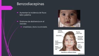 Benzodiacepinas
 Aumentan la incidencia de fisura
labio-palatina
 Síndrome de abstinencia en el
neonato
 irritabilidad y llanto incontrolable.
 