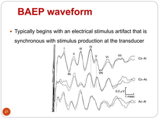 BAEP waveform
27
 Typically begins with an electrical stimulus artifact that is
synchronous with stimulus production at the transducer
 