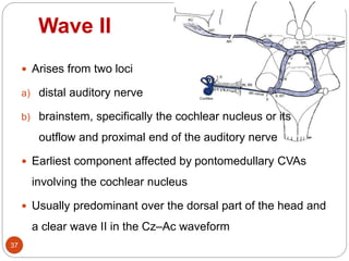 Wave II
37
 Arises from two loci
a) distal auditory nerve
b) brainstem, specifically the cochlear nucleus or its
outflow and proximal end of the auditory nerve
 Earliest component affected by pontomedullary CVAs
involving the cochlear nucleus
 Usually predominant over the dorsal part of the head and
a clear wave II in the Cz–Ac waveform
 