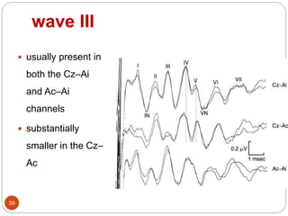 wave III
39
 usually present in
both the Cz–Ai
and Ac–Ai
channels
 substantially
smaller in the Cz–
Ac
 