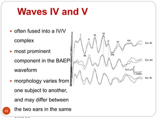 Waves IV and V
43
 often fused into a IV/V
complex
 most prominent
component in the BAEP
waveform
 morphology varies from
one subject to another,
and may differ between
the two ears in the same
 