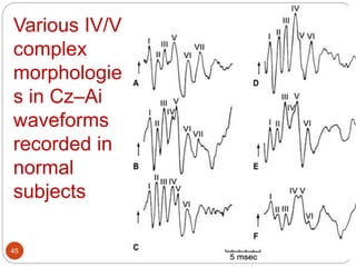 Various IV/V
complex
morphologie
s in Cz–Ai
waveforms
recorded in
normal
subjects
45
 