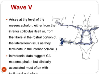 Wave V
48
 Arises at the level of the
mesencephalon, either from the
inferior colliculus itself or, from
the fibers in the rostral portion of
the lateral lemniscus as they
terminate in the inferior colliculus
 Intracranial data suggest C/L
mesencephalon but clinically
associated most often with
 