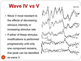 Wave IV vs V
49
 Wave V most resistant to
the effects of decreasing
stimulus intensity or
increasing stimulus rate
 If either of these stimulus
modifications is performed
progressively until only
one component remains,
that peak can be identified
as wave V
 