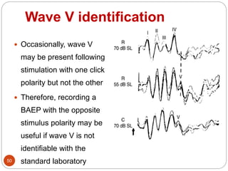 Wave V identification
50
 Occasionally, wave V
may be present following
stimulation with one click
polarity but not the other
 Therefore, recording a
BAEP with the opposite
stimulus polarity may be
useful if wave V is not
identifiable with the
standard laboratory
 