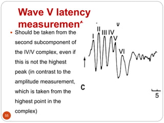 Wave V latency
measurement
55
 Should be taken from the
second subcomponent of
the IV/V complex, even if
this is not the highest
peak (in contrast to the
amplitude measurement,
which is taken from the
highest point in the
complex)
 