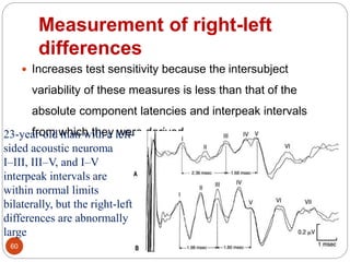Measurement of right-left
differences
60
 Increases test sensitivity because the intersubject
variability of these measures is less than that of the
absolute component latencies and interpeak intervals
from which they were derived23-year-old man with a left-
sided acoustic neuroma
I–III, III–V, and I–V
interpeak intervals are
within normal limits
bilaterally, but the right-left
differences are abnormally
large
 