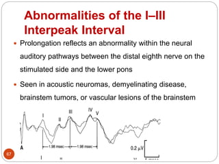 Abnormalities of the I–III
Interpeak Interval
67
 Prolongation reflects an abnormality within the neural
auditory pathways between the distal eighth nerve on the
stimulated side and the lower pons
 Seen in acoustic neuromas, demyelinating disease,
brainstem tumors, or vascular lesions of the brainstem
 