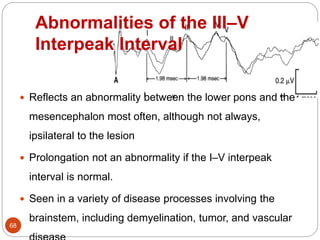 Abnormalities of the III–V
Interpeak Interval
68
 Reflects an abnormality between the lower pons and the
mesencephalon most often, although not always,
ipsilateral to the lesion
 Prolongation not an abnormality if the I–V interpeak
interval is normal.
 Seen in a variety of disease processes involving the
brainstem, including demyelination, tumor, and vascular
 