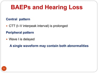 BAEPs and Hearing Loss
71
Central pattern
 CTT (I–V interpeak interval) is prolonged
Peripheral pattern
 Wave I is delayed
A single waveform may contain both abnormalities
 