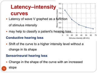 Latency–intensity
curves
73
 Latency of wave V graphed as a function
of stimulus intensity
 may help to classify a patient's hearing loss
Conductive hearing loss
 Shift of the curve to a higher intensity level without a
change in its shape
Sensorineural hearing loss
 Change in the shape of the curve with an increased
slope
 