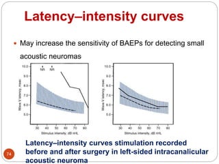 Latency–intensity curves
74
 May increase the sensitivity of BAEPs for detecting small
acoustic neuromas
Latency–intensity curves stimulation recorded
before and after surgery in left-sided intracanalicular
acoustic neuroma
 