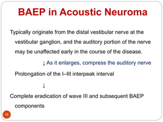 BAEP in Acoustic Neuroma
78
Typically originate from the distal vestibular nerve at the
vestibular ganglion, and the auditory portion of the nerve
may be unaffected early in the course of the disease.
↓ As it enlarges, compress the auditory nerve
Prolongation of the I–III interpeak interval
↓
Complete eradication of wave III and subsequent BAEP
components
 