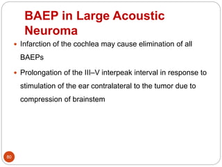 BAEP in Large Acoustic
Neuroma
80
 Infarction of the cochlea may cause elimination of all
BAEPs
 Prolongation of the III–V interpeak interval in response to
stimulation of the ear contralateral to the tumor due to
compression of brainstem
 