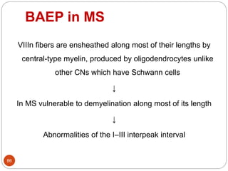 BAEP in MS
86
VIIIn fibers are ensheathed along most of their lengths by
central-type myelin, produced by oligodendrocytes unlike
other CNs which have Schwann cells
↓
In MS vulnerable to demyelination along most of its length
↓
Abnormalities of the I–III interpeak interval
 