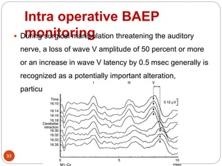 Intra operative BAEP
monitoring
93
 During surgical manipulation threatening the auditory
nerve, a loss of wave V amplitude of 50 percent or more
or an increase in wave V latency by 0.5 msec generally is
recognized as a potentially important alteration,
particularly when it occurs suddenly
 