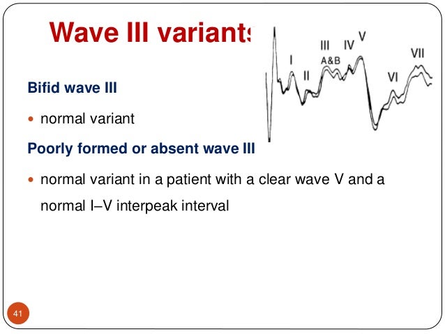 Bera waves mnemonic Bera waves mnemonic