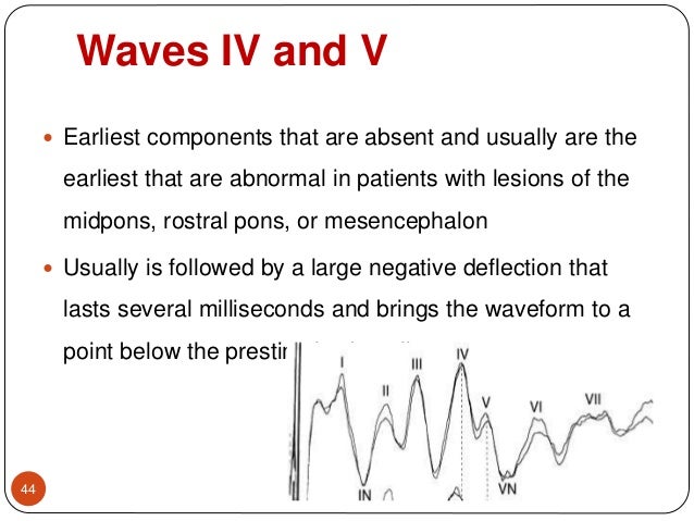 Bera waves mnemonic Bera waves mnemonic
