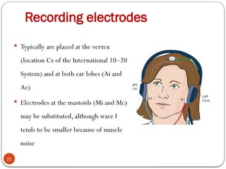Recording electrodes
21
 Typically are placed at the vertex
(location Cz of the International 10–20
System) and at both ear lobes (Ai and
Ac)
 Electrodes at the mastoids (Mi and Mc)
may be substituted, although wave I
tends to be smaller because of muscle
noise
 
